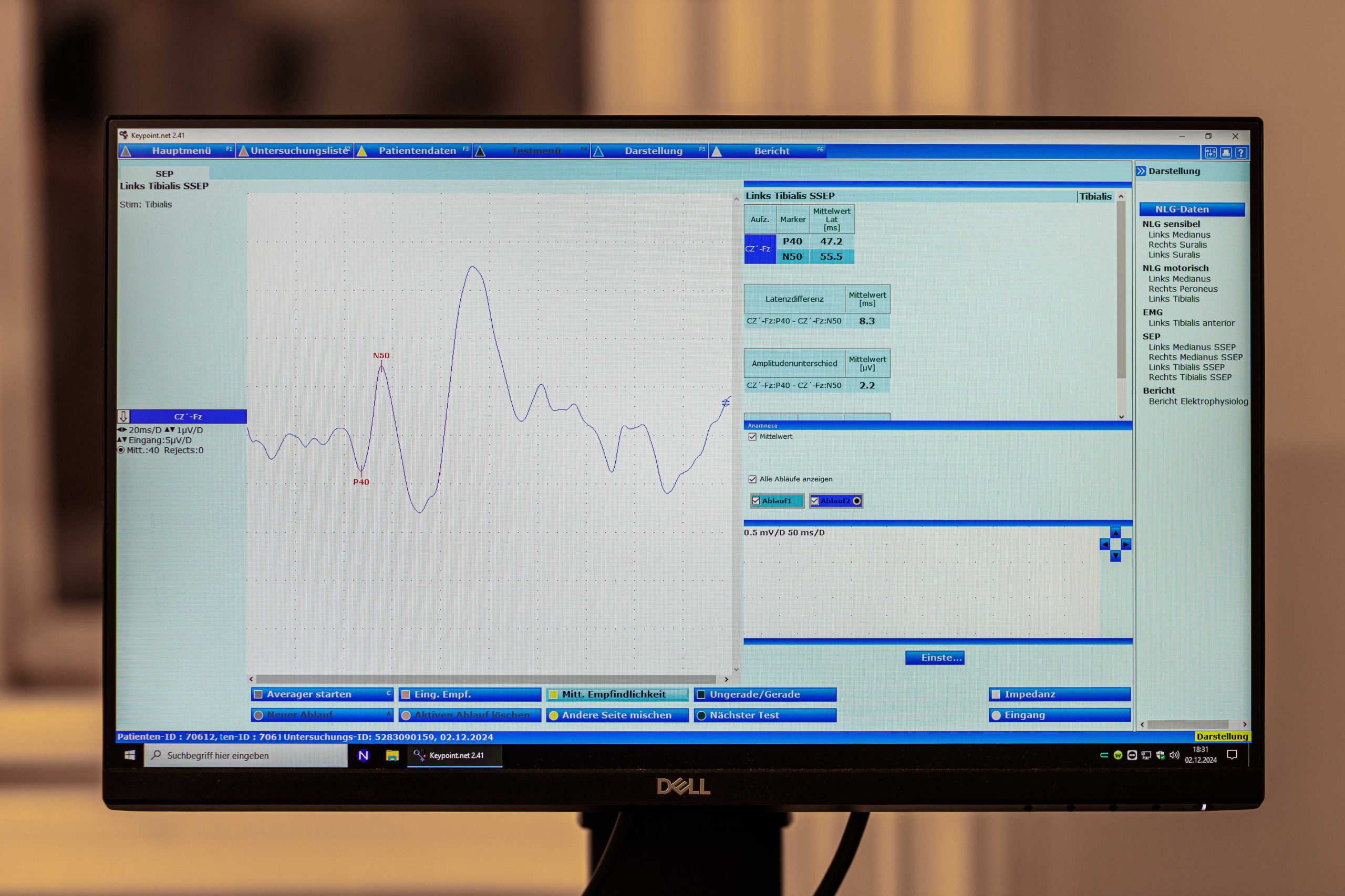 Evozierte Potnetiale