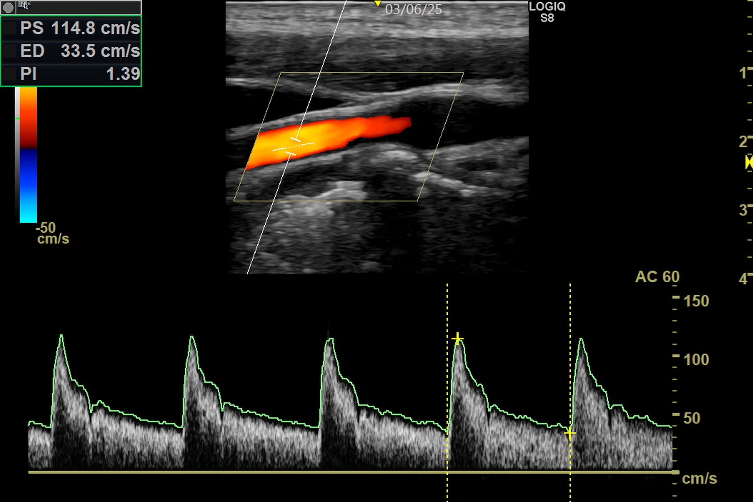 Ultraschall_2560_1707